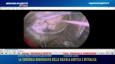 La chirurgia mininvasiva della valvola aortica e mitralica